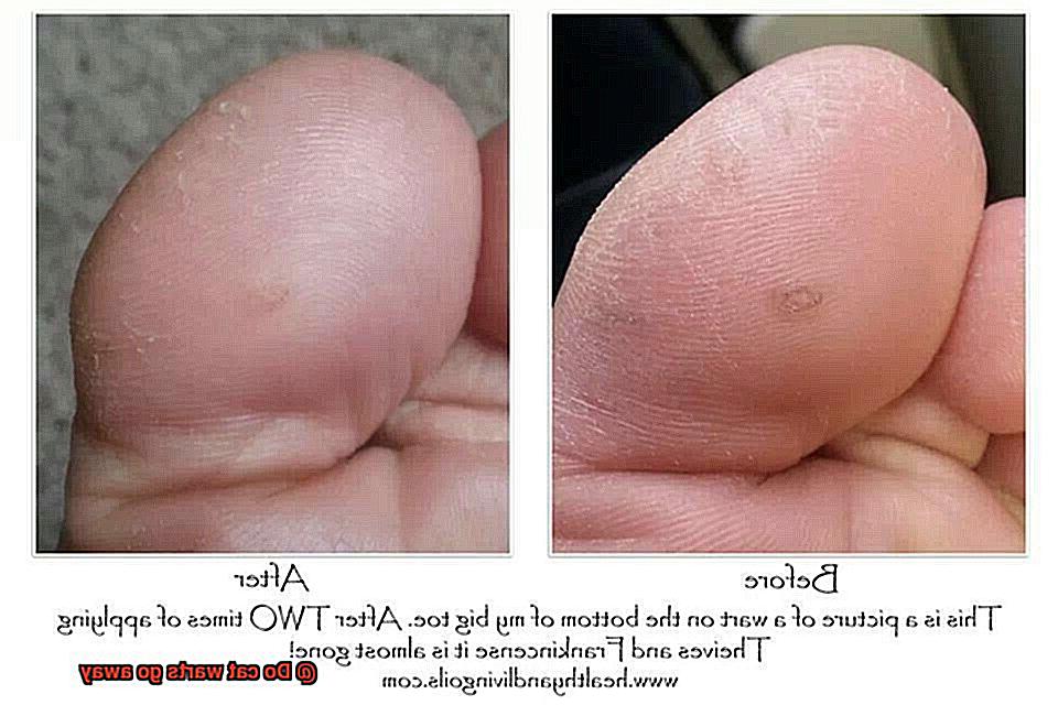 Do cat warts go away-7