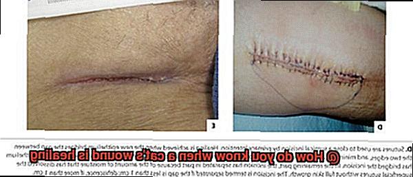 How do you know when a cat's wound is healing-2