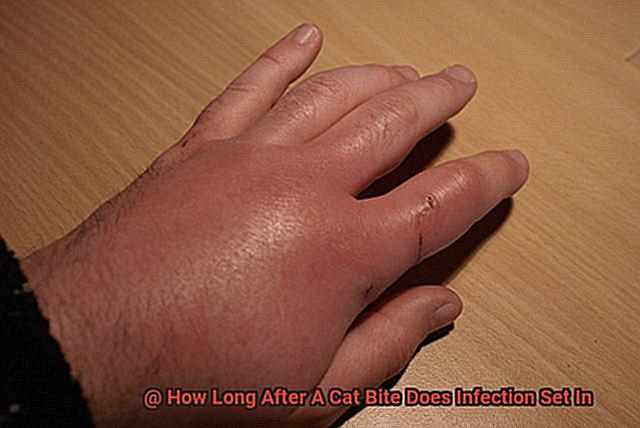 How Long After A Cat Bite Does Infection Set In-3