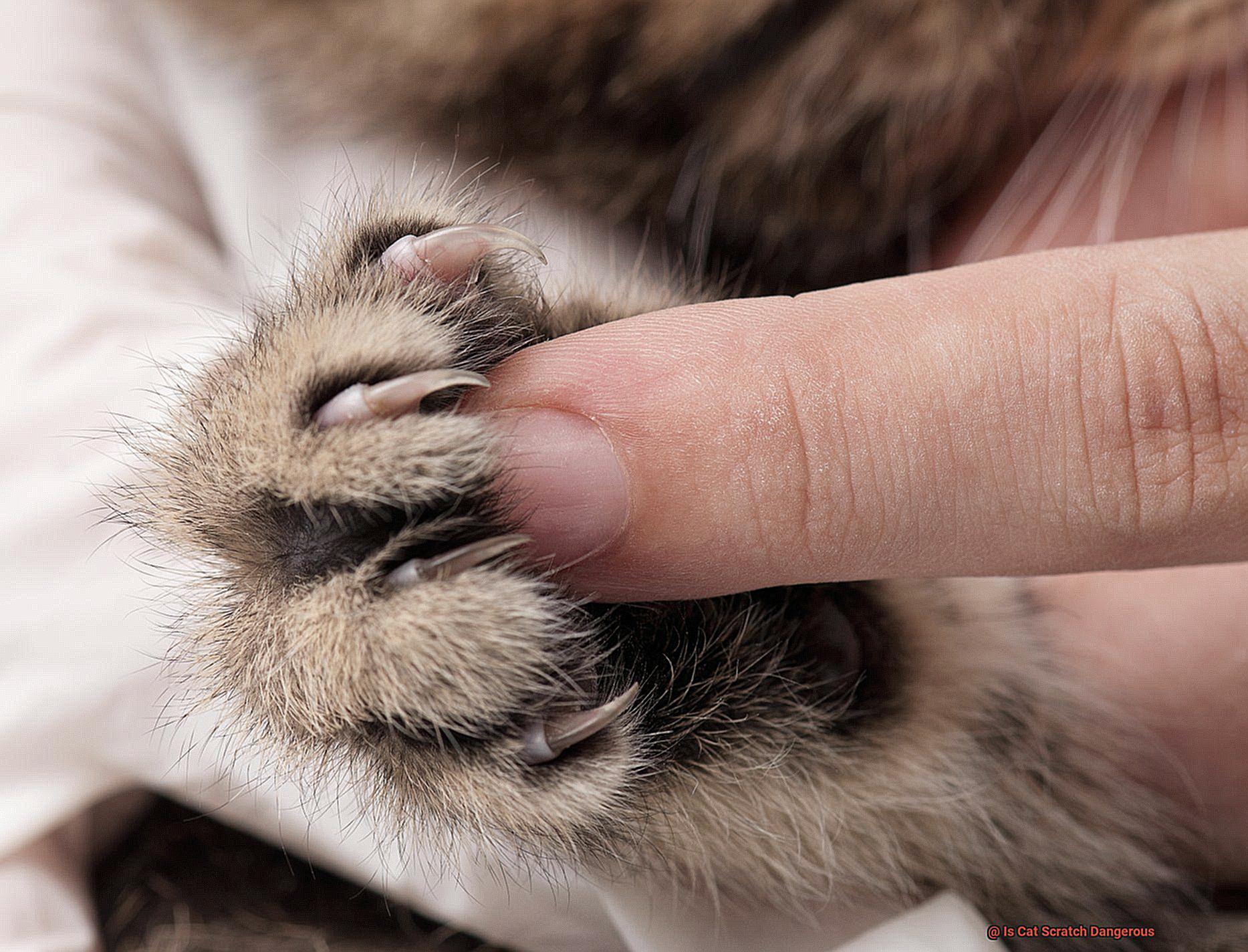 Is Cat Scratch Dangerous-3