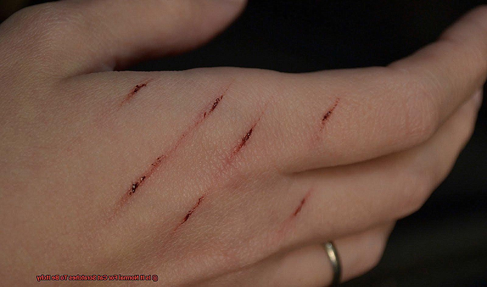 Is It Normal For Cat Scratches To Be Itchy-2